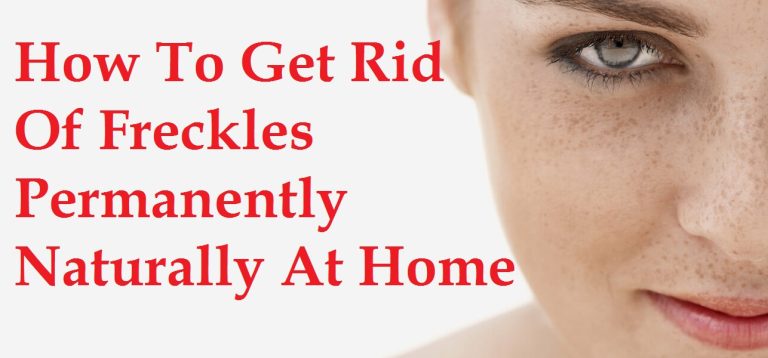 How To Get Rid Of Freckles Permanently Naturally At Home Trends 2024 3639