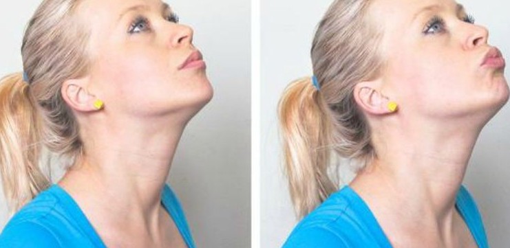 chin lifts exercise to loose face fat