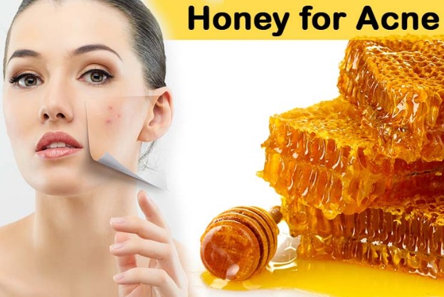 Honey Treats Acne & Acne Scars