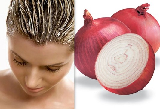 Onion And Lemon Juice Pack To Get Rid Of White Hairs Naturally