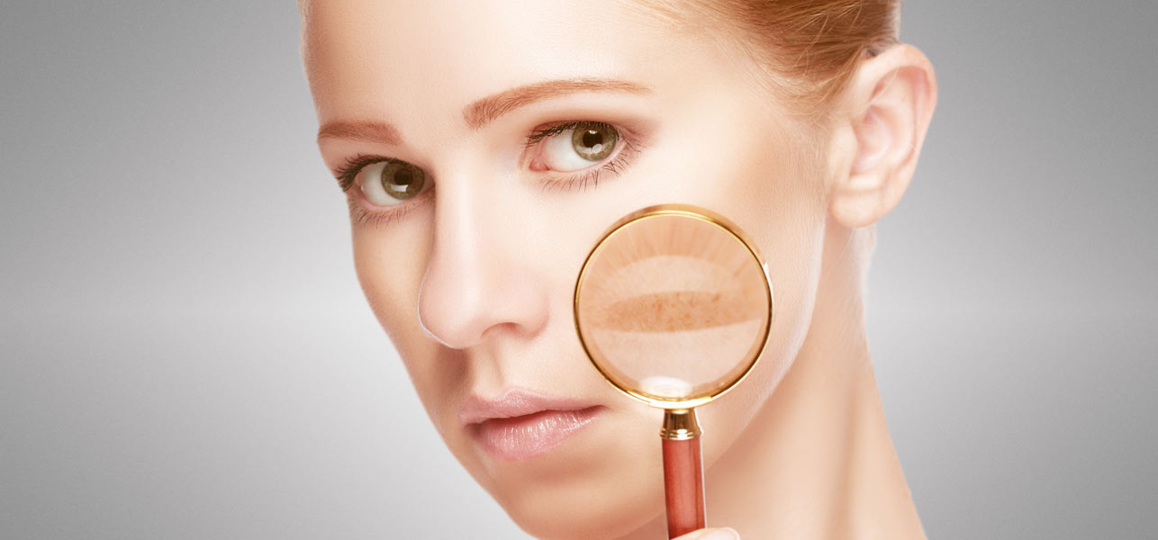 tips to remove skin pigmentation