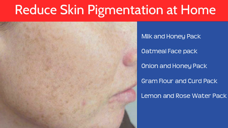 how to reduce skin pigmantation