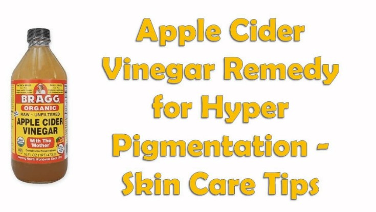 apple cider vinegarTo Get Rid Of Pigmentation