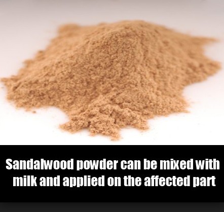 Sandalwood To Get Rid Of Pigmentation