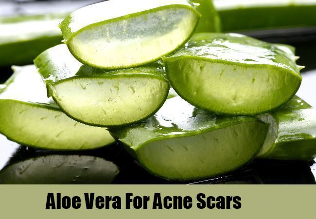 aloe vera gel health benefits 