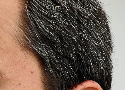 Castor Oil Prevents Premature Of Hairs