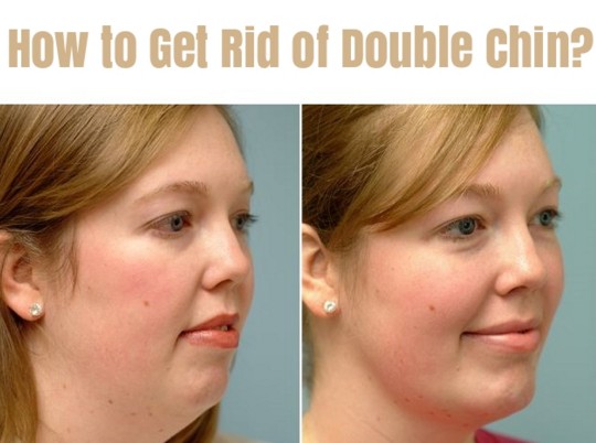 Home Remedies To Get Rid Of Double Chin Fast & Naturally