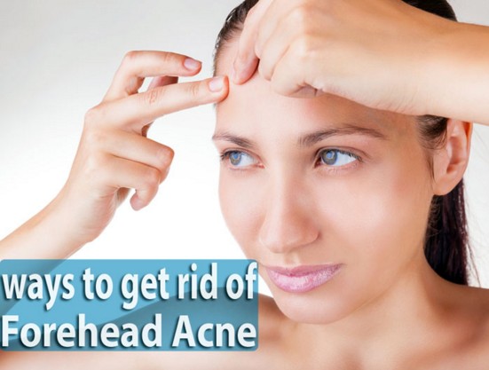 to cure forehead pimples