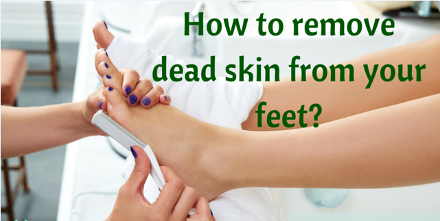 how to remove dead skin on toes 
