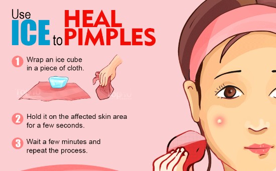 Ice To Cure Pimples On Forehead