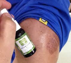 neem oil for wounds 