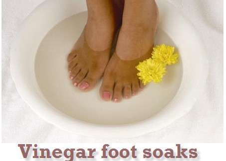 vinegar foe feet