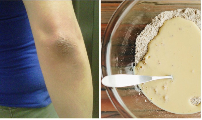 yogurt To Remove Dry Skin From elbow 