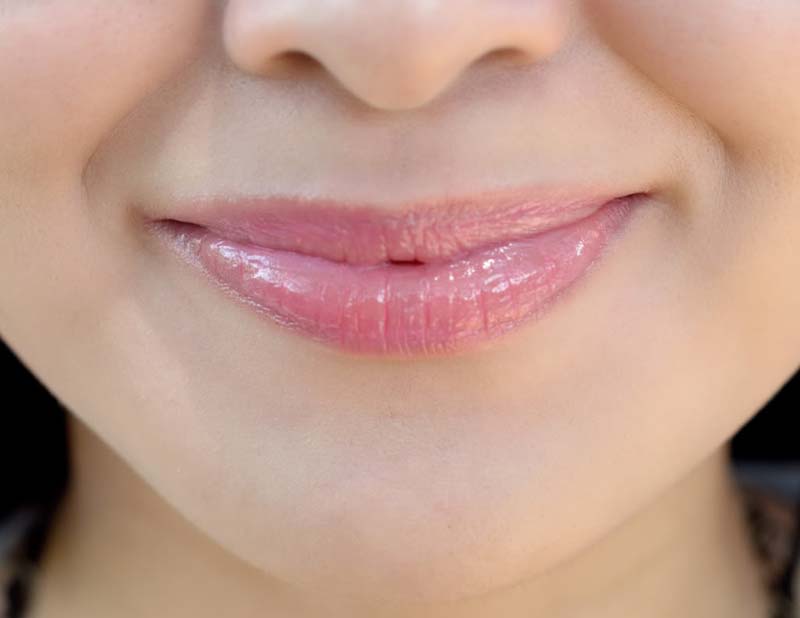 how to get rid of dark lips